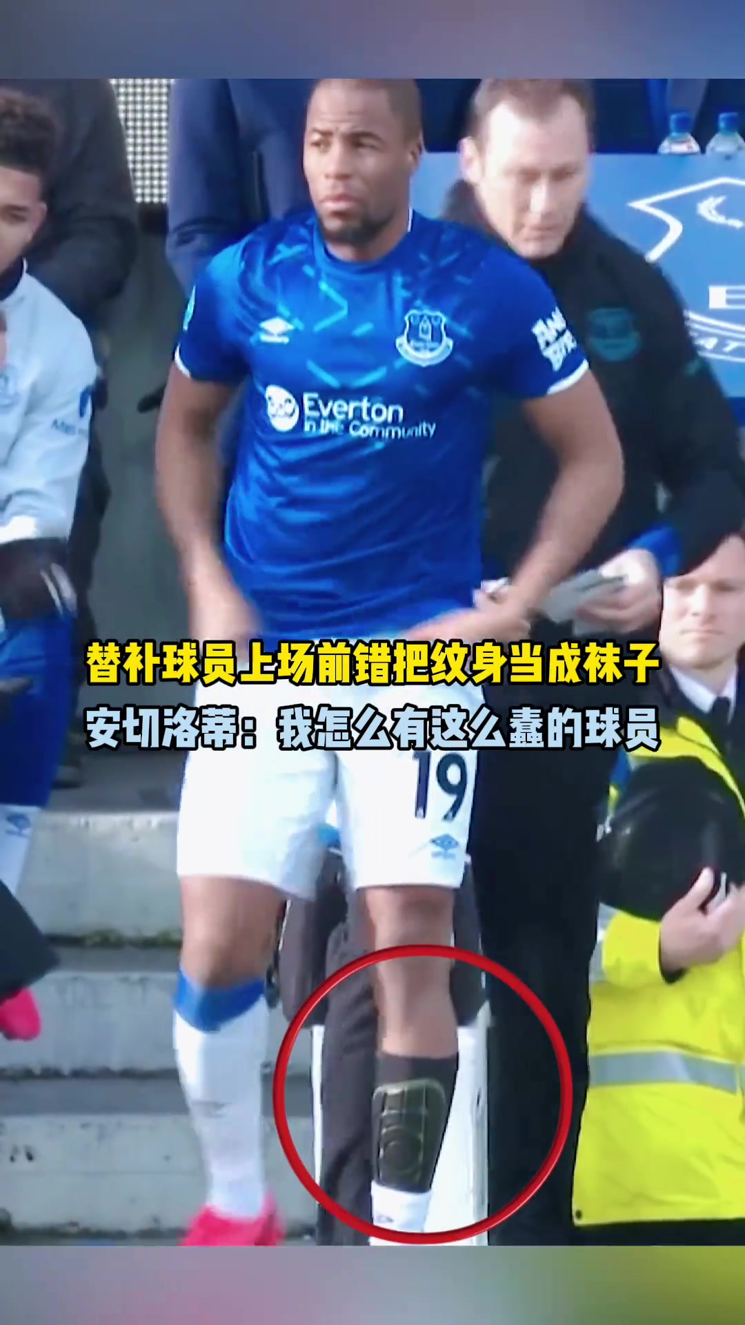替补球员上场错把纹身当球袜,安切洛蒂:我怎么有这么蠢的球员
