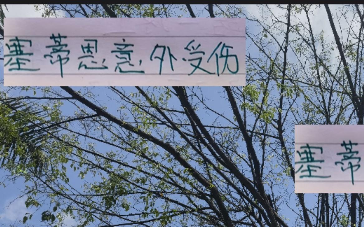 這也太巧！去年蘇亞雷斯拄了個拐沒想到今年輪到塞蒂恩開了個瓢