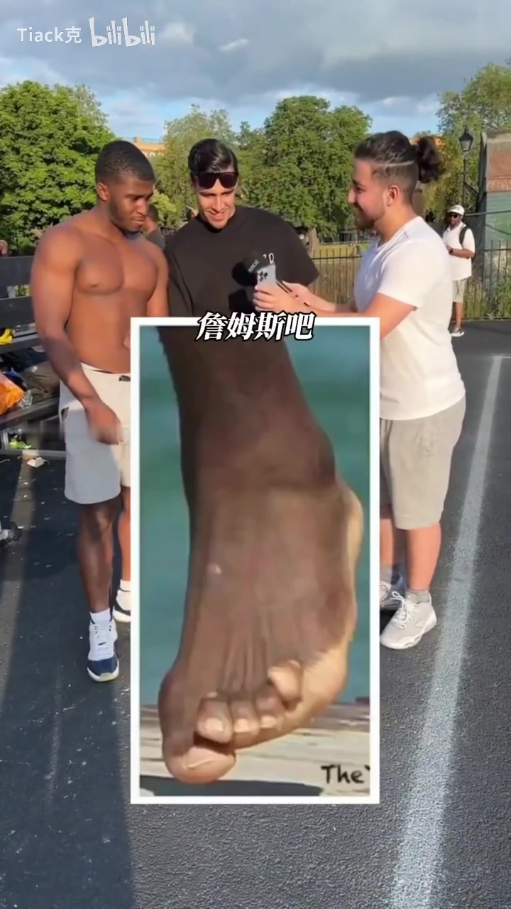 视频会引起不适！职业球员的代价，这竟然是詹姆斯和哈登的脚